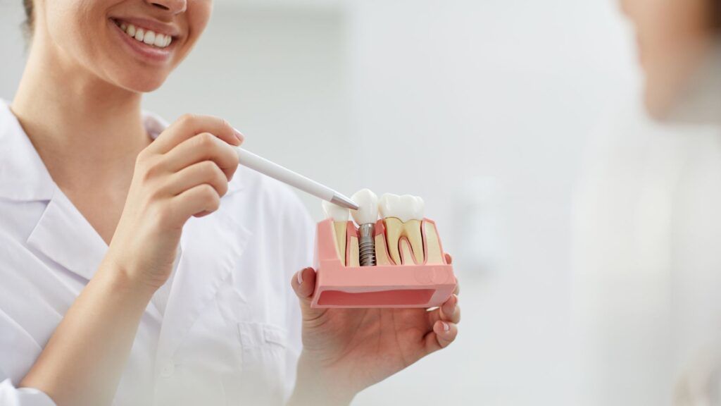 Implantes dentales: qué debes saber antes de planificar tu tratamiento Implantes dentales: qué debes saber antes de planificar tu tratamiento